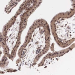Vasohibin Antibody, Novus Biologicals 25 &mu;L; Unlabeled:Antibodies, Polyclonal