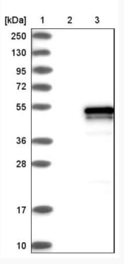 Vasohibin Antibody, Novus Biologicals 25 &mu;L; Unlabeled:Antibodies, Polyclonal