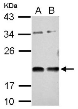 Vasohibin Antibody, Novus Biologicals 0.1mL; Unlabeled:Antibodies, Polyclonal