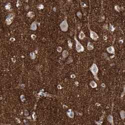 Versican Antibody, Novus Biologicals 0.1mL; Unlabeled:Antibodies, Polyclonal