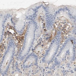 Versican Antibody, Novus Biologicals 0.1mL; Unlabeled:Antibodies, Polyclonal