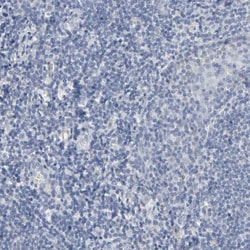 Versican Antibody, Novus Biologicals 0.1mL; Unlabeled:Antibodies, Polyclonal