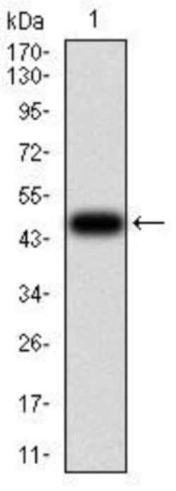 Villin 1 Antibody (3E5G11) - BSA Free, Novus Biologicals 0.1mg; Unlabeled:Antibodies,