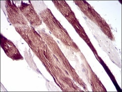 Villin 1 Antibody (5E3B2) - BSA Free, Novus Biologicals:Antibodies:Primary