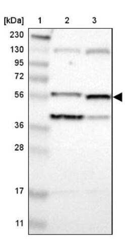 Villin 1 Antibody, Novus Biologicals:Antibodies:Primary Antibodies