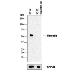 Vimentin Antibody (2A52), Novus Biologicals:Antibodies:Primary Antibodies