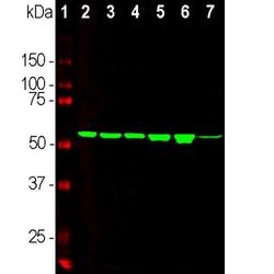Vimentin Antibody (2A52), Novus Biologicals:Antibodies:Primary Antibodies