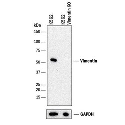 Vimentin Antibody (2D1), Novus Biologicals 0.025mL; Unlabeled:Antibodies,