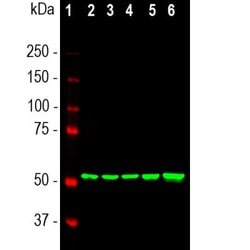 Vimentin Antibody (2D1), Novus Biologicals 0.025mL; Unlabeled:Antibodies,