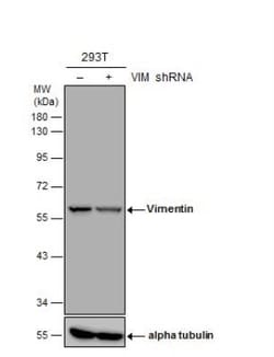 Vimentin Antibody (812), Novus Biologicals 0.1mL; Unlabeled:Antibodies,