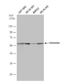 Vimentin Antibody (812), Novus Biologicals 0.1mL; Unlabeled:Antibodies,