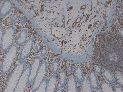 Vimentin Antibody (RV203) - BSA Free, Novus Biologicals 0.1mg; Unlabeled:Antibodies,