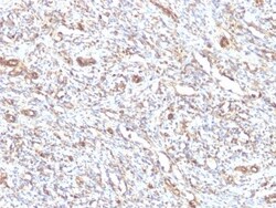 Vimentin Antibody (VM1170), Novus Biologicals 0.2 mg | Buy Online | Novus Biologicals | Fisher Scientific