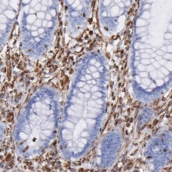 Vimentin Antibody, Novus Biologicals:Antibodies:Primary Antibodies
