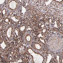 Vimentin Antibody, Novus Biologicals:Antibodies:Primary Antibodies