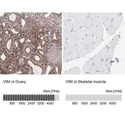 Vimentin Antibody, Novus Biologicals:Antibodies:Primary Antibodies