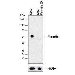 Vimentin Antibody, Novus Biologicals:Antibodies:Primary Antibodies