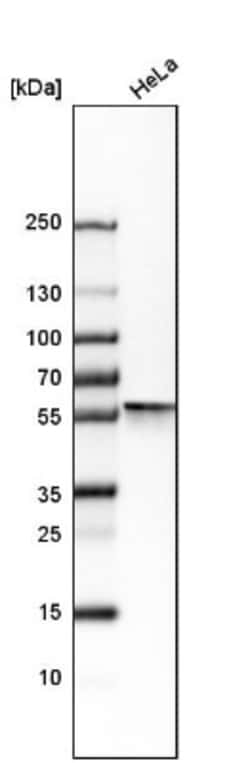 Vimentin Antibody, Novus Biologicals:Antibodies:Primary Antibodies