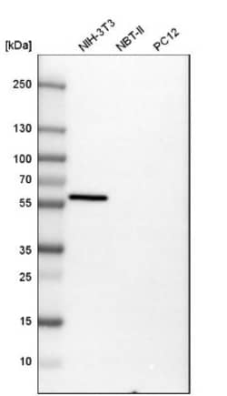 Vimentin Antibody, Novus Biologicals:Antibodies:Primary Antibodies