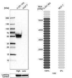 Vimentin Antibody, Novus Biologicals:Antibodies:Primary Antibodies