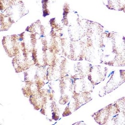 Vinculin Rabbit anti-Human, Mouse, Rat, Clone: 3J7P3, Novus Biologicals 20 &mu;g | Buy Online | Novus Biologicals | Fisher Scientific