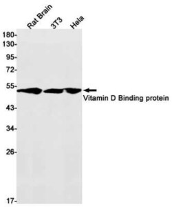 Vitamin D BP Rabbit anti-Human, Clone: S03-5G8, Novus Biologicals 25 &mu;g | Buy Online | Bio-Techne | Fisher Scientific