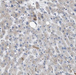 Vitamin D BP Antibody, Novus Biologicals 0.1mL; Unlabeled:Antibodies, Polyclonal