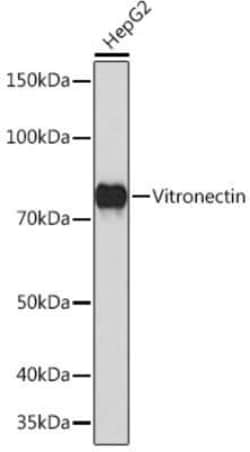 Vitronectin Rabbit anti-Human, Clone: 2V2V8, Novus Biologicals 20 &mu;g | Buy Online | Novus Biologicals | Fisher Scientific