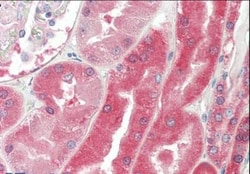 Von Hippel Lindau Antibody, Novus Biologicals 0.1mg; Unlabeled:Antibodies,