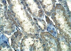 Von Hippel Lindau Antibody, Novus Biologicals 100 &mu;g; Unconjugated:Antibodies,
