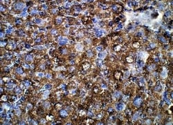 Von Hippel Lindau Antibody, Novus Biologicals 100 &mu;g; Unconjugated:Antibodies,