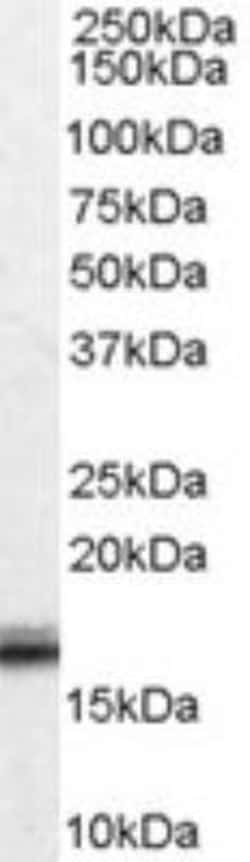 Von Hippel Lindau Antibody, Novus Biologicals 0.1mg; Unlabeled:Antibodies,