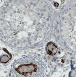 Von Willebrand Factor Antibody (CL1957), Novus Biologicals:Antibodies:Primary