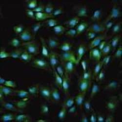 Von Willebrand Factor Antibody, Novus Biologicals 0.1mL; Unlabeled:Antibodies,