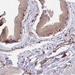 WASF2 Antibody, Novus Biologicals:Antibodies:Primary Antibodies