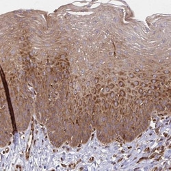 WASF2 Antibody, Novus Biologicals:Antibodies:Primary Antibodies