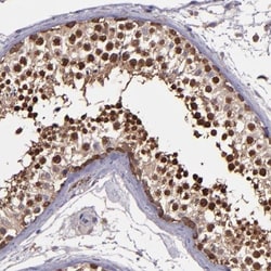 WASHC1 Antibody, Novus Biologicals 0.1mL; Unlabeled:Antibodies, Polyclonal