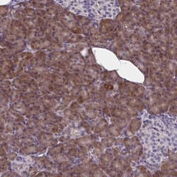 WBP1 Antibody, Novus Biologicals 25 &mu;L | Buy Online | Novus Biologicals | Fisher Scientific