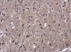 WBP11 Antibody, Novus Biologicals 0.1mL; Unlabeled:Antibodies, Polyclonal