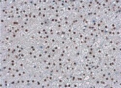 WBP11 Antibody, Novus Biologicals 0.1mL; Unlabeled:Antibodies, Polyclonal