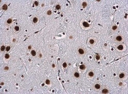WBP11 Antibody, Novus Biologicals 0.1mL; Unlabeled:Antibodies, Polyclonal