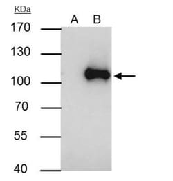WBP11 Antibody, Novus Biologicals 0.1mL; Unlabeled:Antibodies, Polyclonal