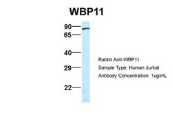WBP11 Antibody, Novus Biologicals 100&mu;L; Unlabeled:Antibodies, Polyclonal