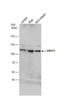 WBP11 Antibody, Novus Biologicals 0.1mL; Unlabeled:Antibodies, Polyclonal