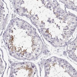 WBP2NL Antibody, Novus Biologicals:Antibodies:Primary Antibodies