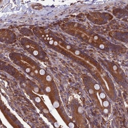 WDR1 Antibody, Novus Biologicals:Antibodies:Primary Antibodies