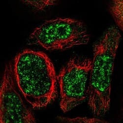 WDR17 Antibody, Novus Biologicals 25 &mu;L; Unlabeled:Antibodies, Polyclonal