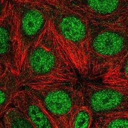 WDR18 Antibody, Novus Biologicals 0.1mL; Unlabeled:Antibodies, Polyclonal