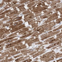 WDR26 Antibody, Novus Biologicals 0.1mL; Unlabeled:Antibodies, Polyclonal