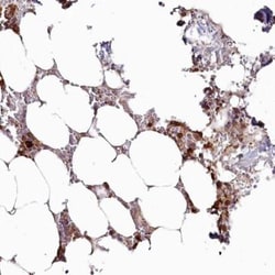 WDR36 Antibody, Novus Biologicals 0.1mL; Unlabeled:Antibodies, Polyclonal
